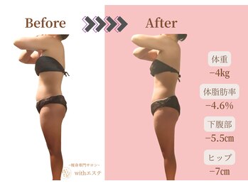 ウィズエステ(withエステ)/