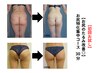 【初回お試し】お尻のたるみを重点的にアプローチ!コース30分¥8,800