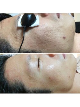 サロン レピア(LEPIA)/メンズエステも力を入れて！！