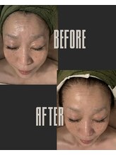 ルサンク(le cinq)/1度目目に見える結果