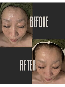 ルサンク(le cinq)/1度目目に見える結果