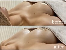 ルナリア ルクス 志木南口駅前店/バストのハリ弾力アップ♪