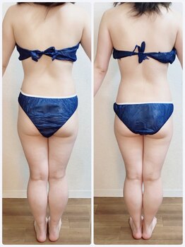 リナル 祐天寺店/150分☆痩身マシン＋全身リンパ