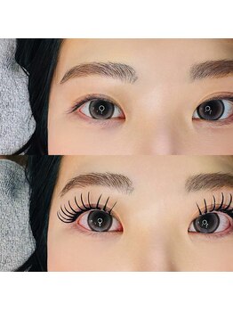 ノイ(neu)/バインドロック/ダブルフラット