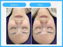 トウメイコガオ 横浜店/トウメイコガオ【ララピール】