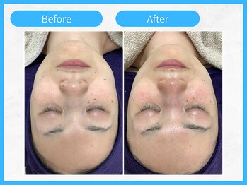 トウメイコガオ 横浜店/トウメイコガオ【ララピール】