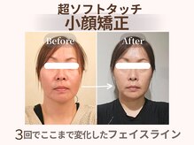 プレシャス(PRECIOUS)