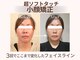 プレシャス(PRECIOUS)の写真