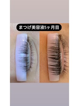 エステサロン エムル(EMURU)/