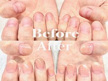 オー 町田モディ店(Oh!)/【スカルプ】深爪矯正☆メンズも