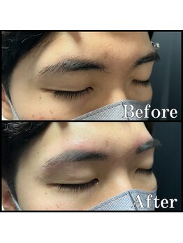 眉毛男子 新宿店/眉毛【 before / after 】