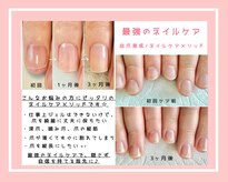 ネイル クリーミー(Nail Creamy)