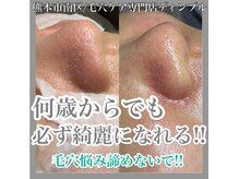 ディンプル(Dimple)の雰囲気（提供する全ての施術のディプロマ取得しております）