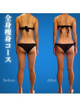 リアン(Lian)/【下半痩せを叶えたい方／痩身】