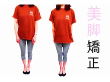 練馬アカデミア美容整体院/ダイエット・下半身ダイエット