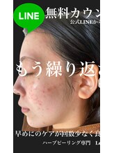 リベル 名古屋(Lebelle:)/ハーブピーリング専門名古屋