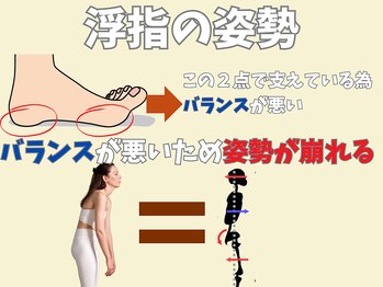 ニコ(niko)/浮指は姿勢を崩し膝が不安定に