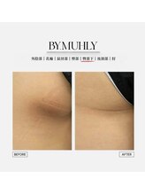 エクラ 天神店(ecla)/バイミューリ メラニンケア◎