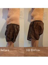 サロン ド モミカル(salon de momikaru)/お腹モニター