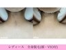 【期間限定価格◎】最新THR脱毛！全身脱毛(顔・VIO付) ¥19,800→¥9,800