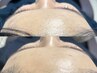 【眉＋顔WAXの贅沢セット】美眉アイブロウWAX脱毛＋お顔１箇所WAX
