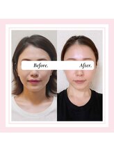 ル フラーズ(Les Fleurs)/全身矯正　側湾をお持ちの方