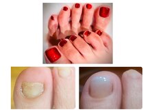 ウォーク(Walk)の雰囲気（トラブル中のお爪でも人工爪でジェルを楽しむことも可能です♪）