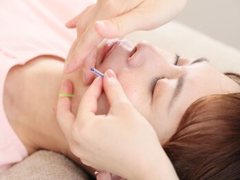 ときのはり鍼灸院(TOKINOHARI)/美容鍼