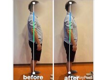 カワル整体 上通り院/お尻の痺れの対策は