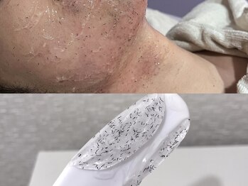 エリクサー 加須店(Elixir)/施術中にヒゲが抜けます◎