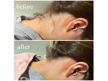 レディソワン(Lady Soin)の雰囲気（イベント前にも★気になるうなじのワックス脱毛！顔脱毛も人気〇）