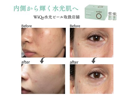 ハク(8AK)の写真