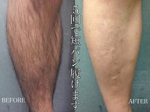 エミュ(emu formen)の雰囲気(エミュのメンズ脱毛は短期で高評価な結果を得られます!)