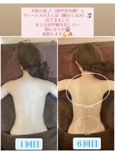 トータルボディケア サニー(TOTAL BODY CARE)/ブライダルエステ・肩甲骨を出す