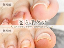 サロン マリス(salon Mariss)の雰囲気（自信をもって素足になれるフットケアしてみませんか？）