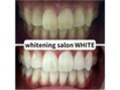 ホワイトニングサロン WHITE 彦根店 【8/17 NEW OPEN（予定）】 の写真