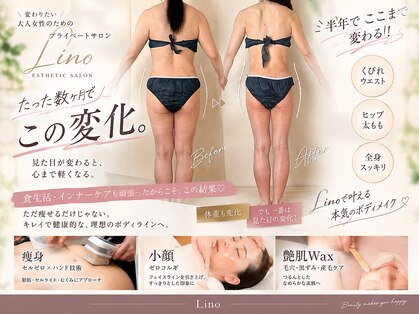 リノ(Lino)の写真