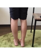 ヨサパーク opit河辺店(YOSAPARK)/驚きの変化！