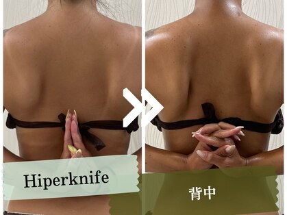 ソルニス(Solnis.)の写真