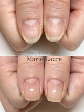 マリーロール 梅田店(Marie Laure)/深爪矯正/自爪育成/自爪風