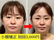 美容整体ウェリナ 名駅院