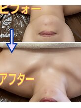 カルミア 心斎橋店/コルギ/40代のお客様