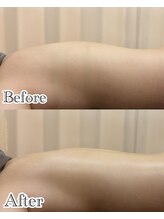 リラ 郡山店(Lilas)/背中の張り気になりませんか？