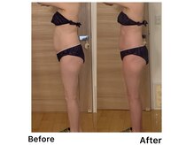 ボンヌシャンスビューティの雰囲気（一度のbefore after／ムリな強さは使わずに状態みて施術します。）