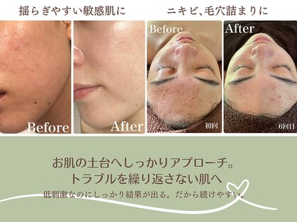 肌質改善サロン　Humming skin【3/2 NEW OPEN（予定）】の写真
