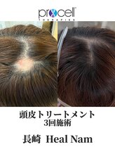 ヒルナム(Heal Nam)/~プロセルセラピーズ~頭皮