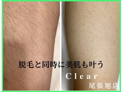 クリア 尾張旭店(Clear)の写真