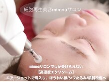 ミモア サロン(mimoa)の雰囲気（エアーショット(空気で美容液をお肌へ浸透させるマシン)で施術☆）