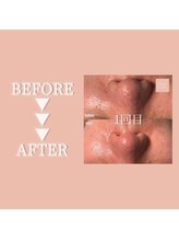 クリアラボ 豊中(Clear Lab)/Before&After