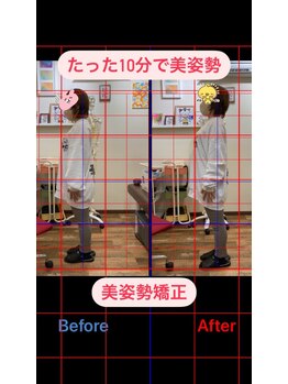 ヒデ整体院(Hide整体院)/猫背矯正骨盤矯正B/A肩こり腰痛
